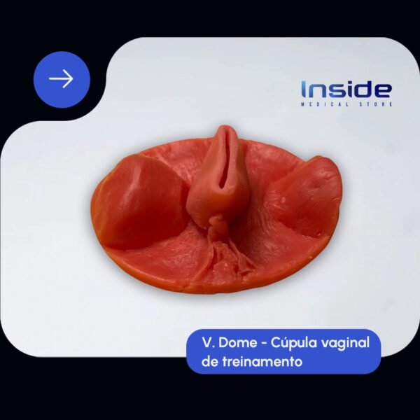 V.dome (cúpula vaginal) - Imagem 4