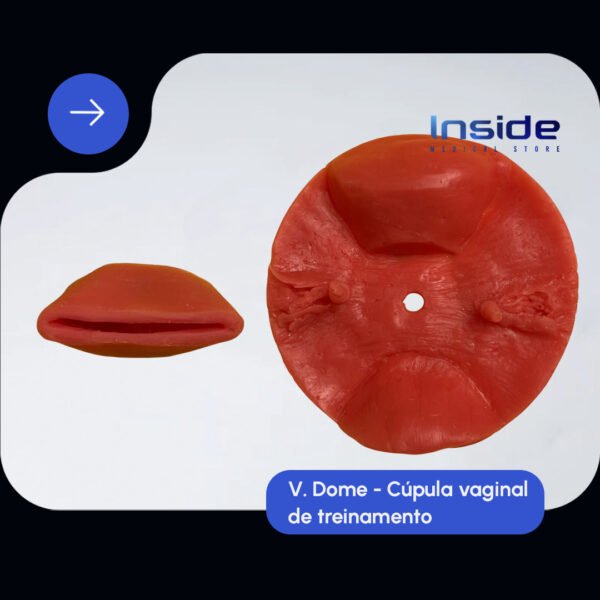 V.dome (cúpula vaginal) - Imagem 3