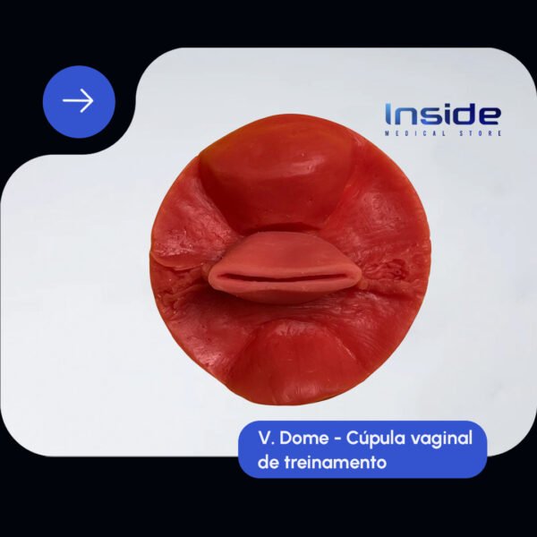 V.dome (cúpula vaginal) - Imagem 2