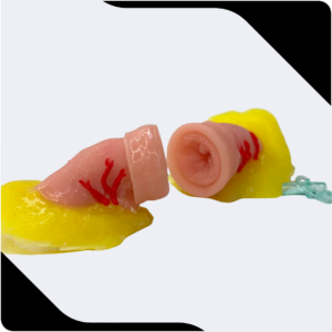Alça Intestinal
